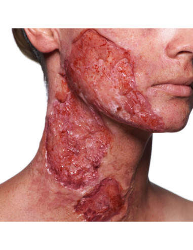 Artex silicone bicomposante effets 3D peau plaies cicatrices FX