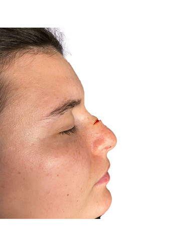 Moules silicone platine SFX plaies chéloïdes Bondo Moulds professionnel