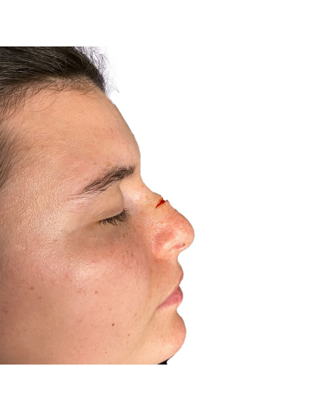 Moules silicone platine SFX plaies chéloïdes Bondo Moulds professionnel