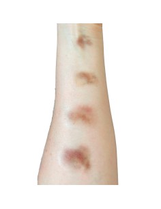 Tatuagens FX hematomas pequenos maquilhagem efeitos especiais cinema teatro 2