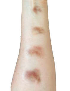 Tatuagens temporárias FX hematomas envelhecidos pequenos maquilhagem cinema teatro 2