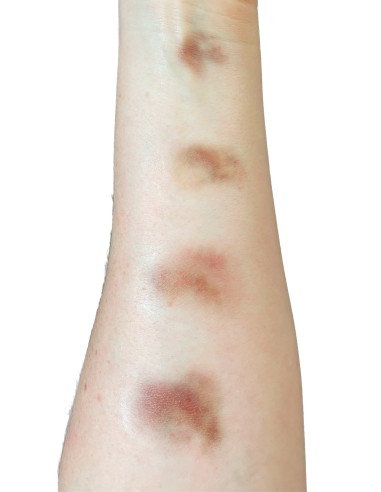 Tatuaggi temporanei FX lividi invecchiati piccoli trucco cinema teatro