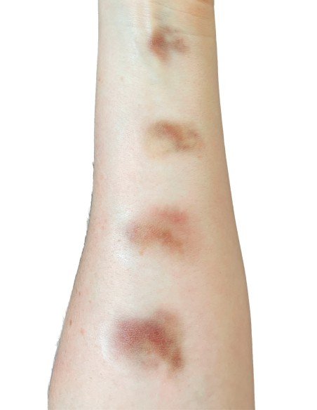 Tatuagens temporárias FX hematomas envelhecidos pequenos maquilhagem cinema teatro