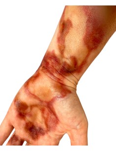 Tatuagens temporárias queimaduras 3º grau hiperrealistas FX maquilhagem 2