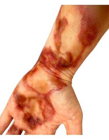 Hyperrealistic third-degree burn temporary tattoos FX makeup