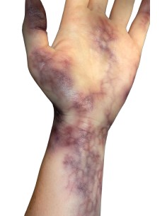 Tatuagens temporárias lividez hematomas cadavéricos SFX maquiagem efeitos 2