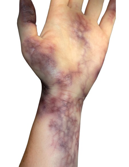 Tatuaggi temporanei lividità lividi cadaverici SFX trucco effetti speciali