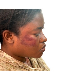 Tatuagens FX hematomas pele escura maquilhagem efeitos especiais câmara 2